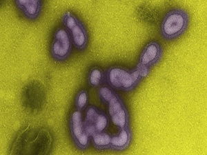 Health ministry reports Thailand’s 18th H1N1 death thumbnail